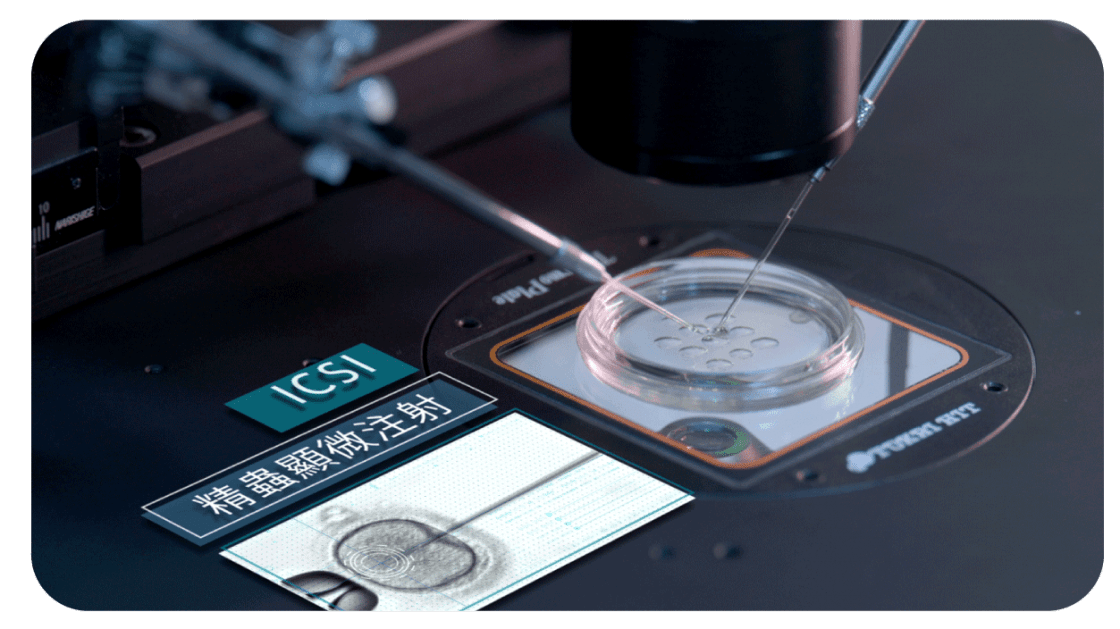 Spindle View prevents damage to the chromosomes on the spindle apparatus during ICSI.