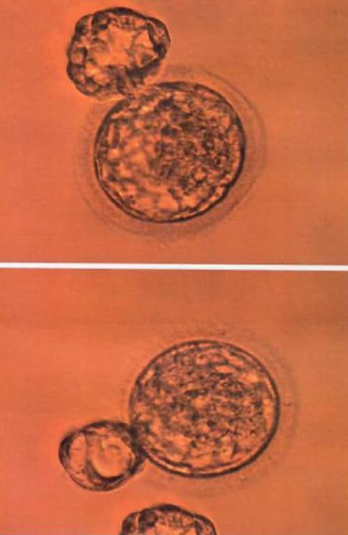 Embryos viewed through a microscope.