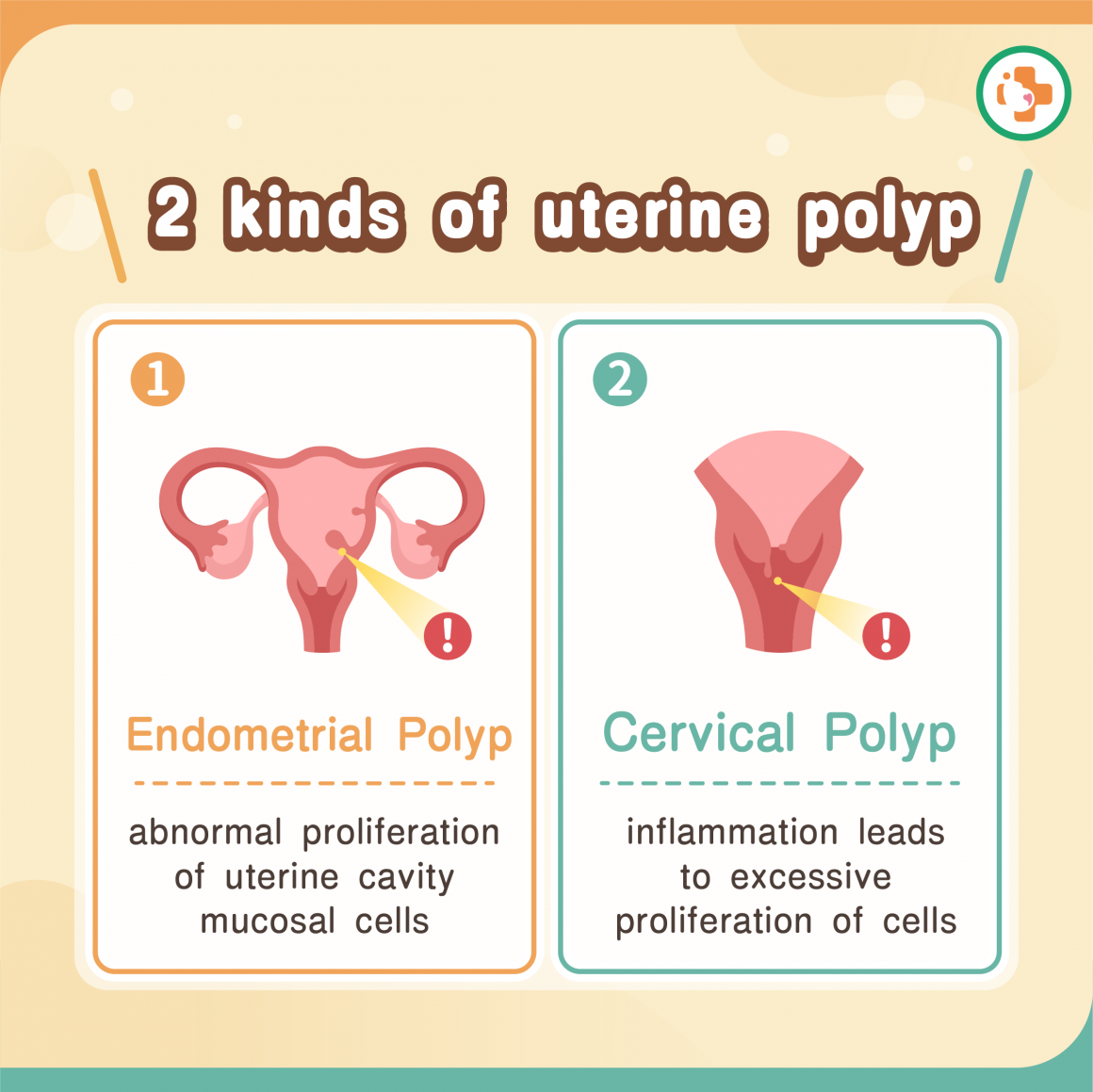 Types of uterine polyps