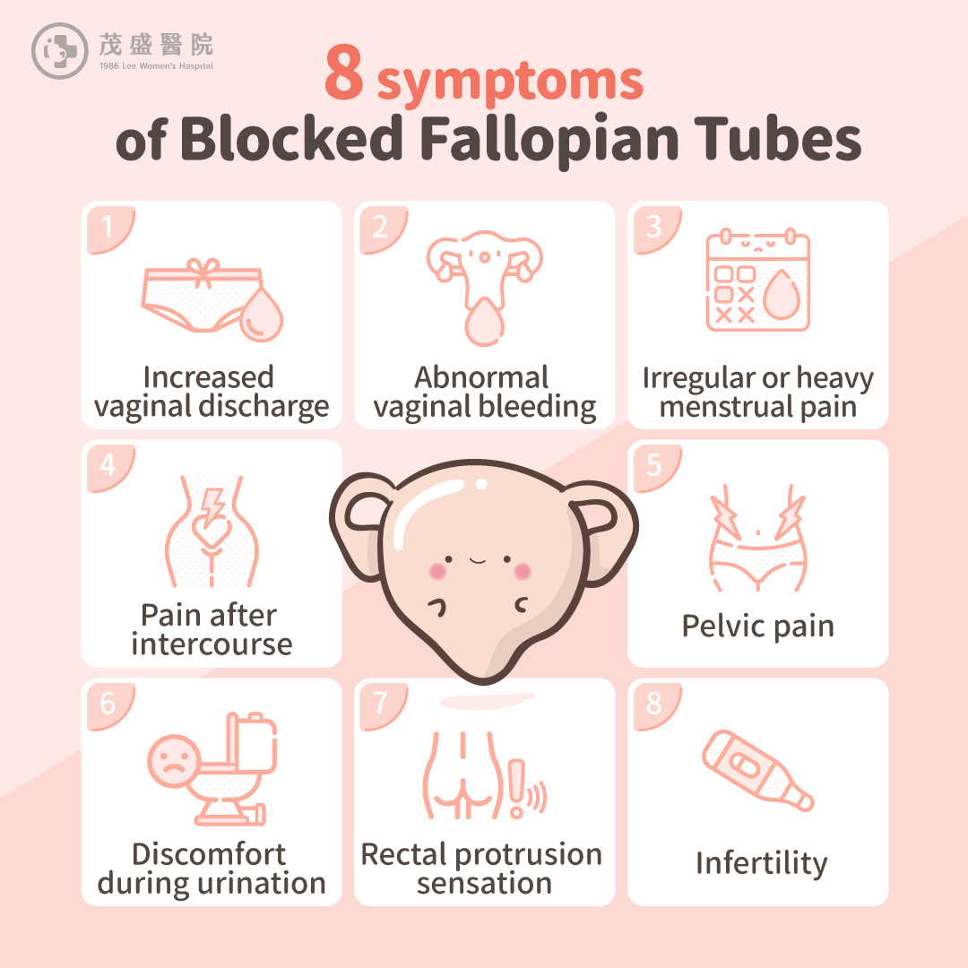 8 Symptoms of Blocked Fallopian Tubes