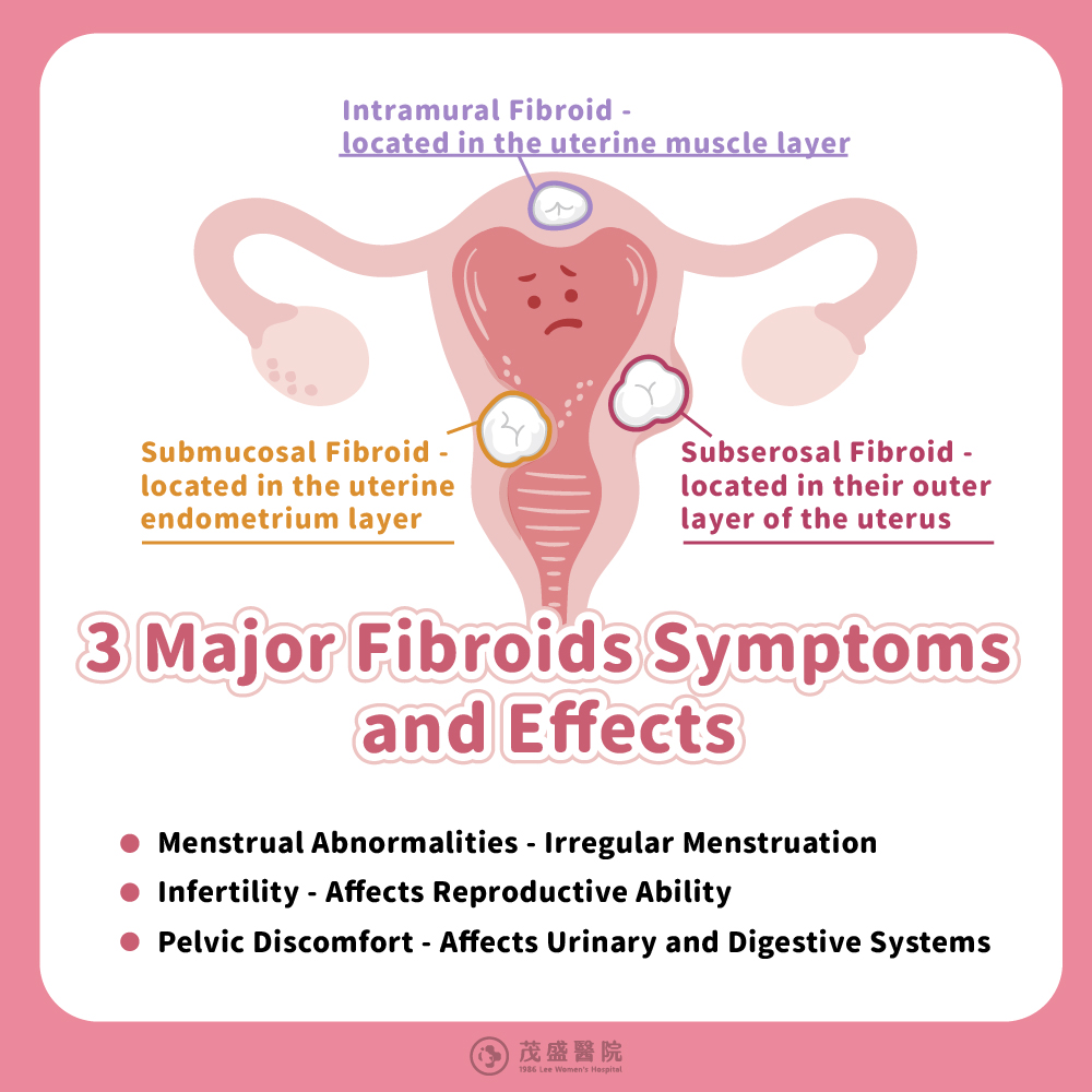 3 Major Fibroids Symptoms and Effects