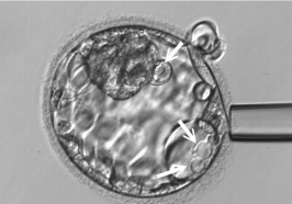 vacuoles(+) vacuoles(+)